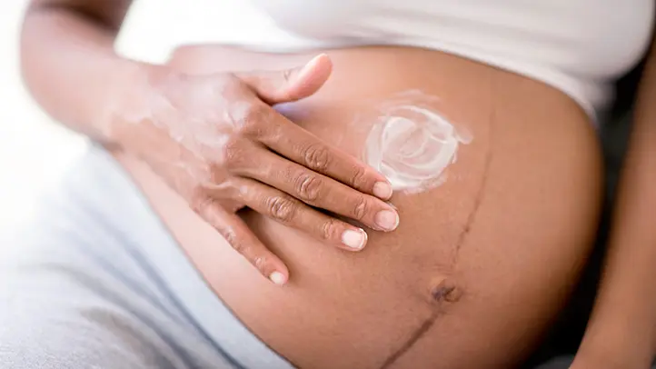 a pregnant woman's belly with cream on her belly