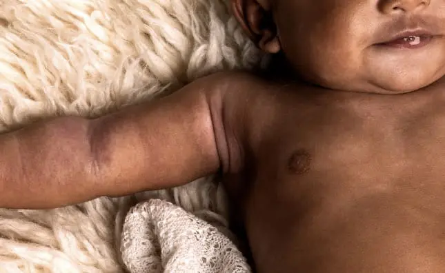 A baby